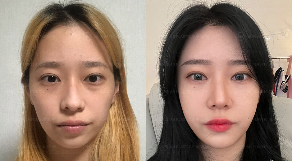 AB Plastic Surgery